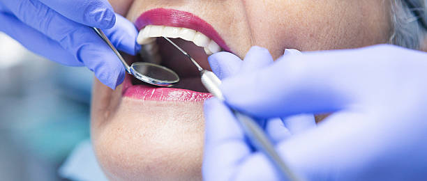 Best Emergency Wisdom Teeth Removal in Hallstead, PA